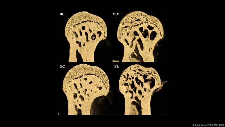 El Impacto de la Gravedad Cero en los Huesos