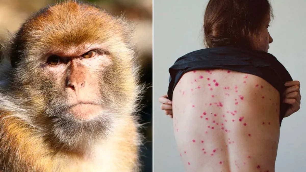 ¿Qué implica este nuevo brote para la salud global?