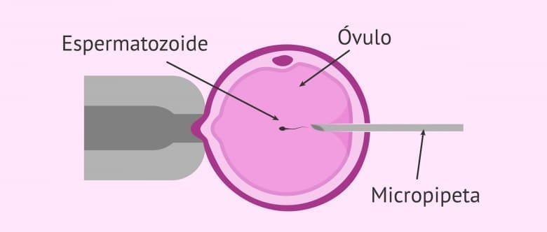 ¿Qué significa que nace el primer bebé por IA?