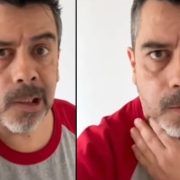 El estrés le cobra factura: Carlos Espejel sufre parálisis facial