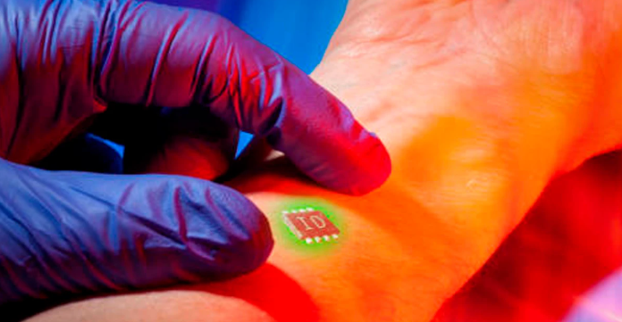 ¿Qué es un chip anti alcoholismo y cómo funciona?