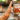 ¡Increíble! Un chip anti alcoholismo que cambia vidas