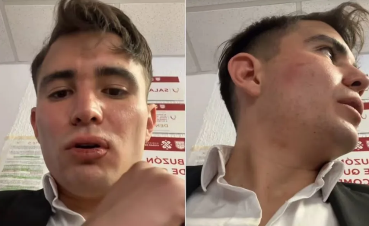 ¿Abuso policial o malentendido? Seguidores exigen justicia