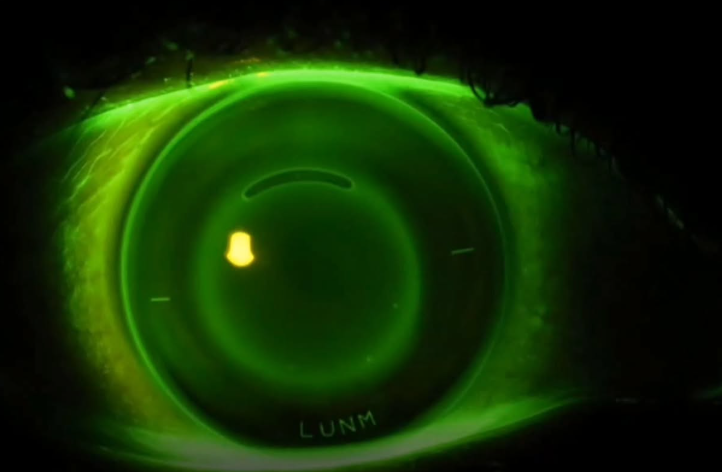 ¿Cómo funcionan estas lentes de contacto visión nocturna?