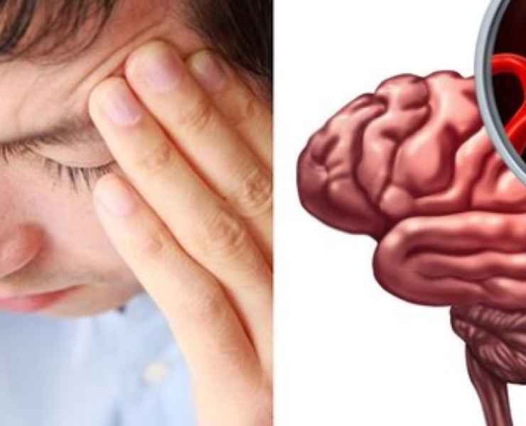 Nano robots para reparar aneurismas cerebrales desde adentro sin cirugía