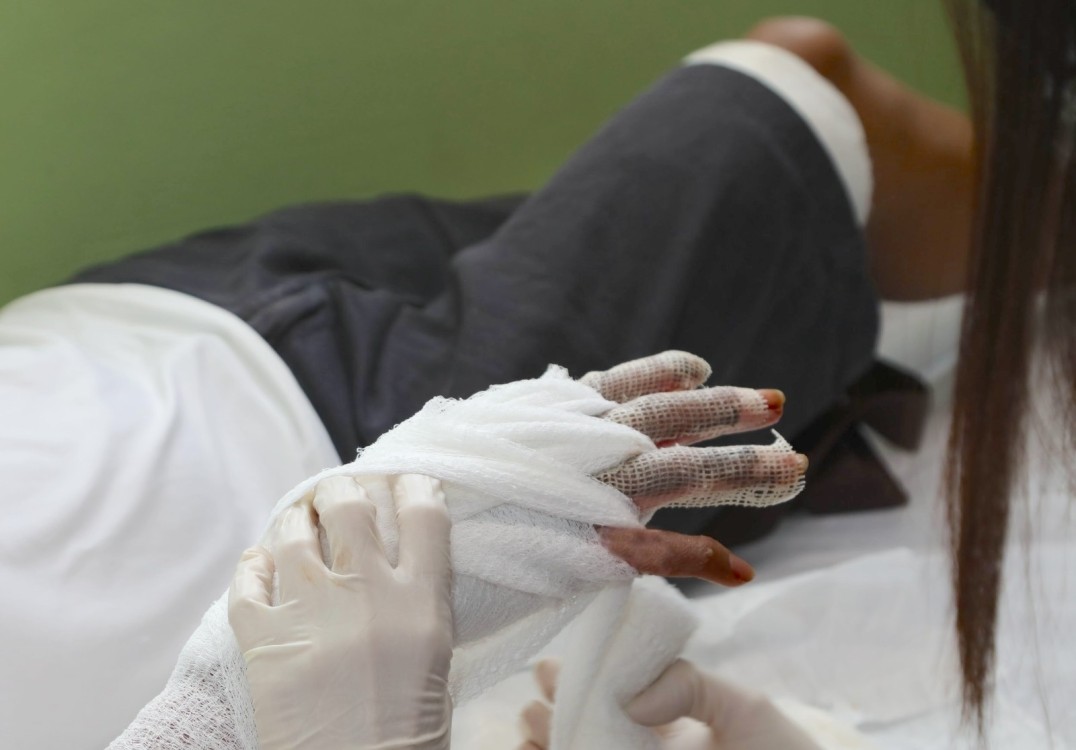 La lepra se puede tratar de manera económica