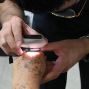 SSY pone en marcha Jornada Extramuros de Dermatología y transforma vidas en el sur de Yucatán