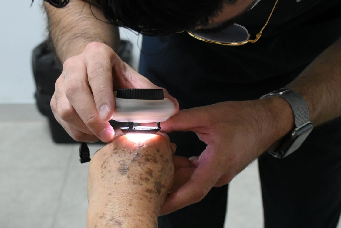 SSY pone en marcha Jornada Extramuros de Dermatología y transforma vidas en el sur de Yucatán