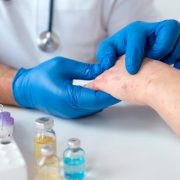 La lepra se puede tratar de manera económica