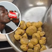 Hombre con 35 piedras en la vejiga por tomar Coca-Cola diariamente
