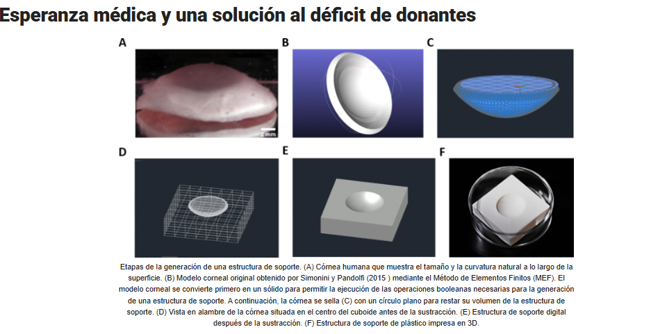 ¿Por qué es tan importante este avance en córneas humanas impresas?