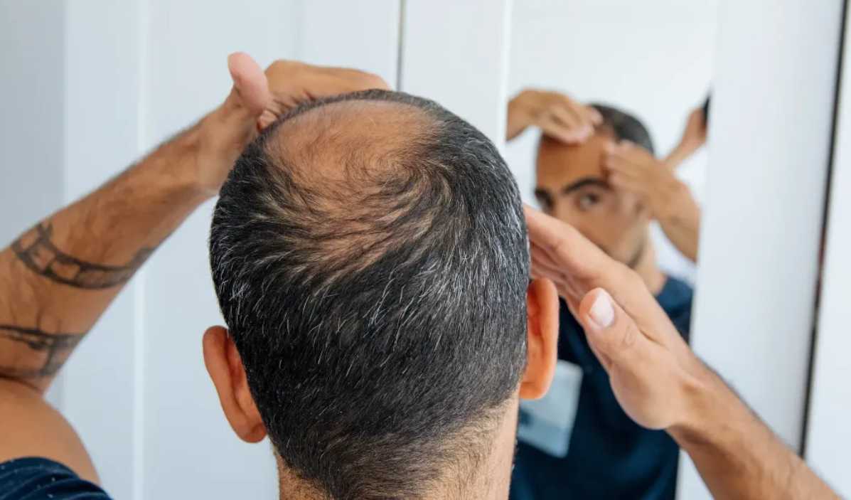 Crean un gel que estimula el cabello para que siga creciendo