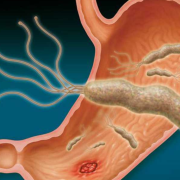 ¿Curan la gastritis? Científica elimina una bacteria que la causa