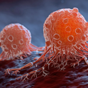 Un hombre descubre un raro cáncer, todo por que se fue a revisar una tos