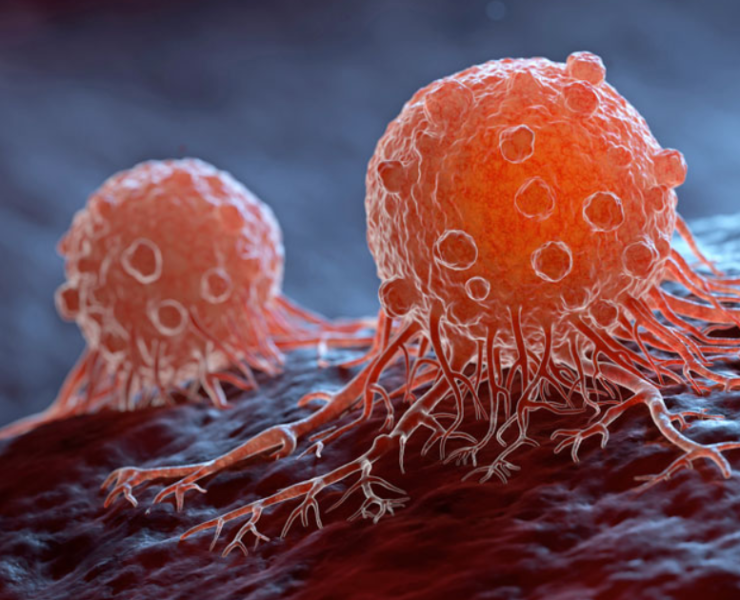 Un hombre descubre un raro cáncer, todo por que se fue a revisar una tos