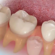 Logran cultivar dientes humanos en un laboratorio de Londres