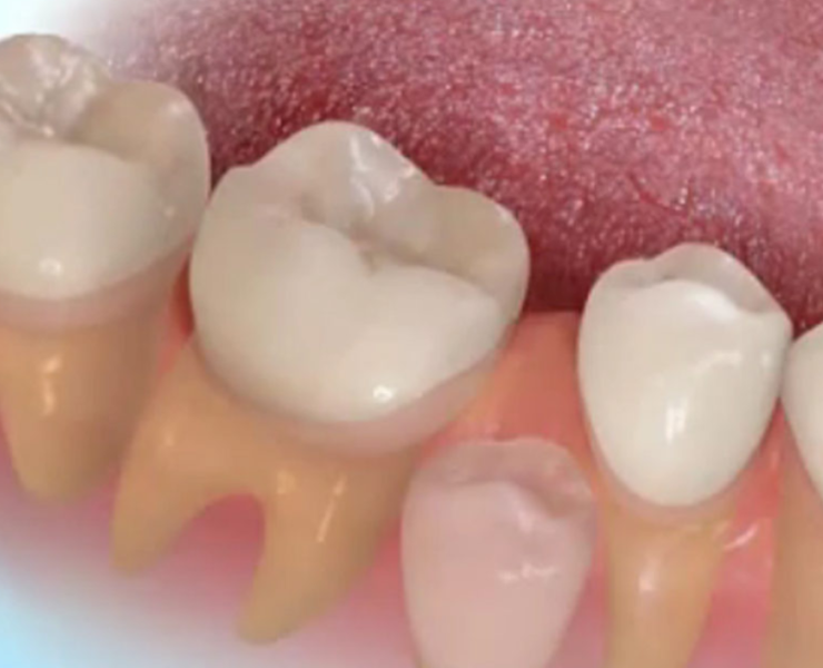 Logran cultivar dientes humanos en un laboratorio de Londres