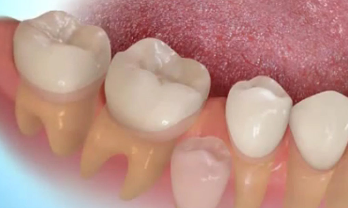 Logran cultivar dientes humanos en un laboratorio de Londres