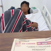 DIF Carmen impulsa cirugías a través del programa labio y paladar hendido