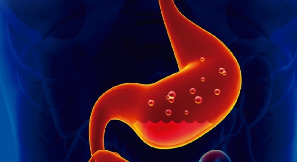 Otros probióticos que podrían ayudar con la gastritis