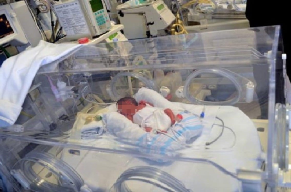 Vida en medio del silencio: nace bebé de mujer con muerte cerebral