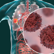 Paciente de cáncer terminal se cura al tomar medicina para animales