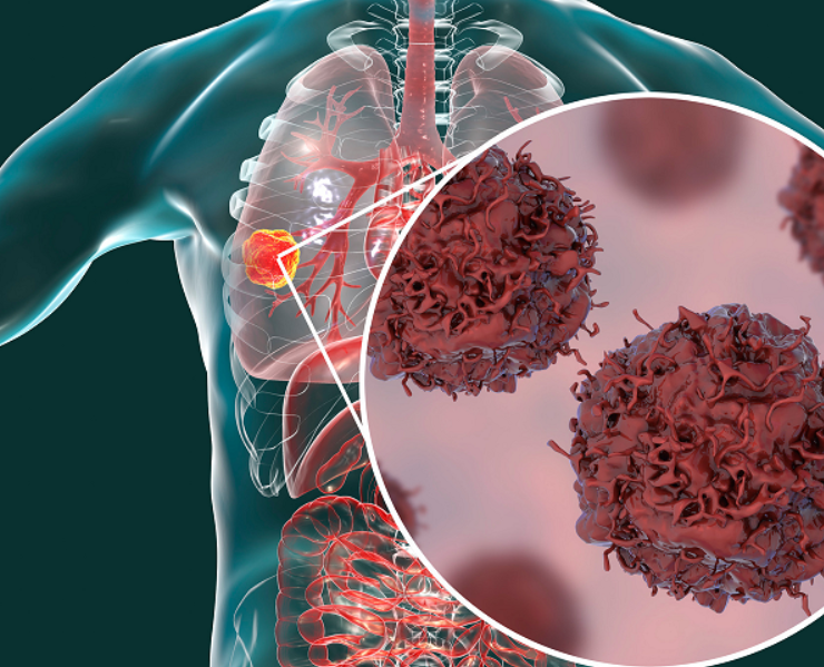 Paciente de cáncer terminal se cura al tomar medicina para animales