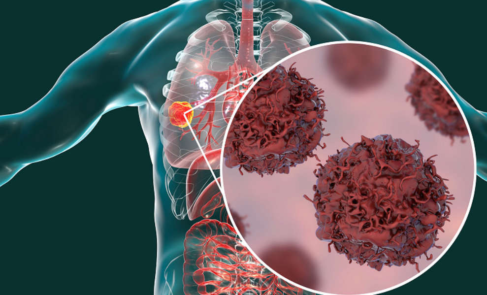 Paciente de cáncer terminal se cura al tomar medicina para animales