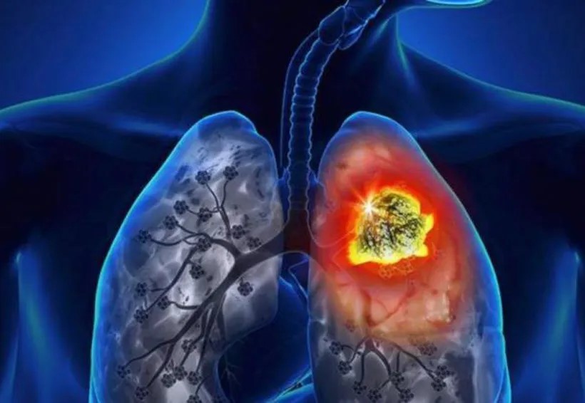 Otros riesgos ambientales más allá del tabaco