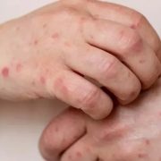 Tabasco supera metas de vacunación