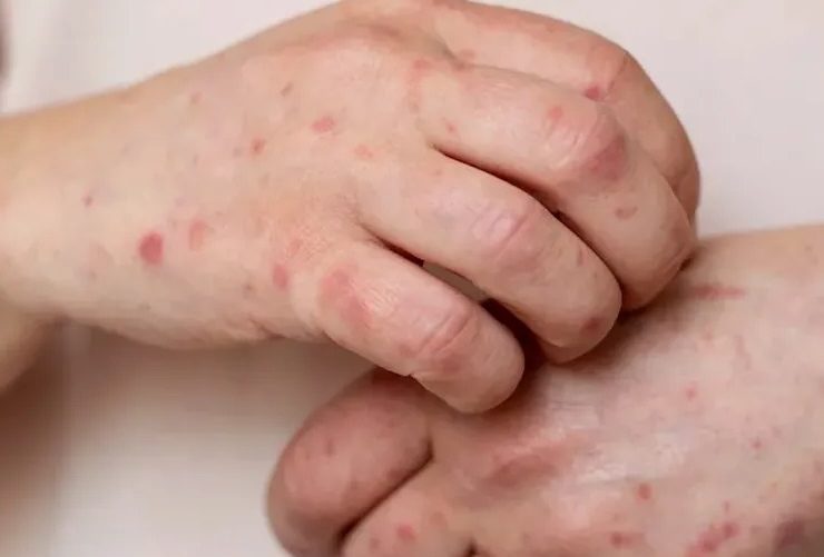 Tabasco supera metas de vacunación