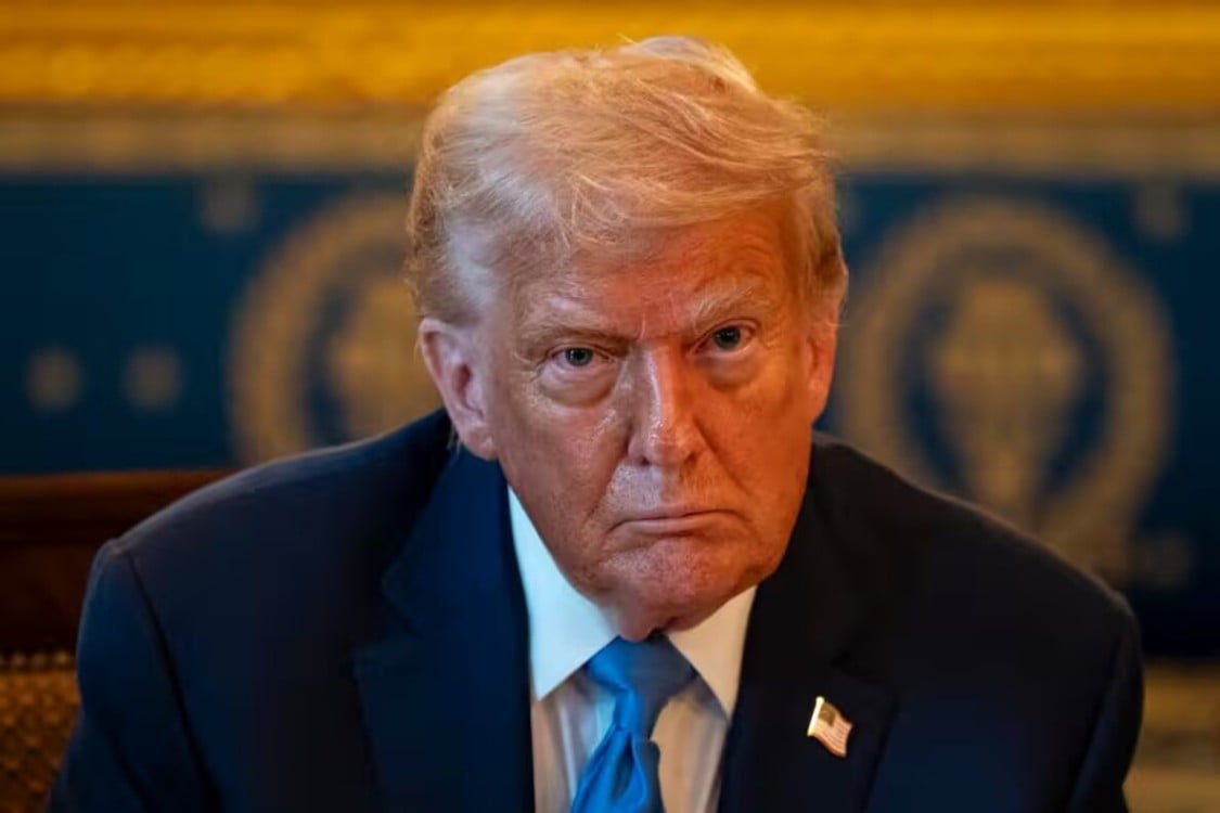 Trump es diagnosticado con insuficiencia venosa crónica