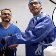 Cirujanos extirpan tumor espinal a través del ojo sin daño alguno