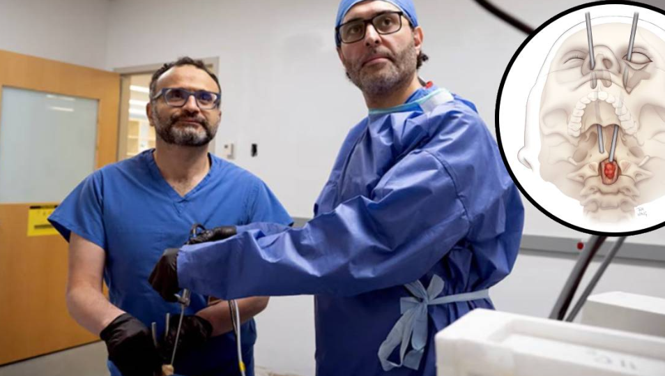 Cirujanos extirpan tumor espinal a través del ojo sin daño alguno