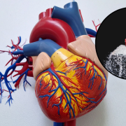 La azúcar daña más que el colesterol a nuestro corazón