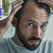 Las bebidas energéticas favorecen la calvicie según estudios recientes