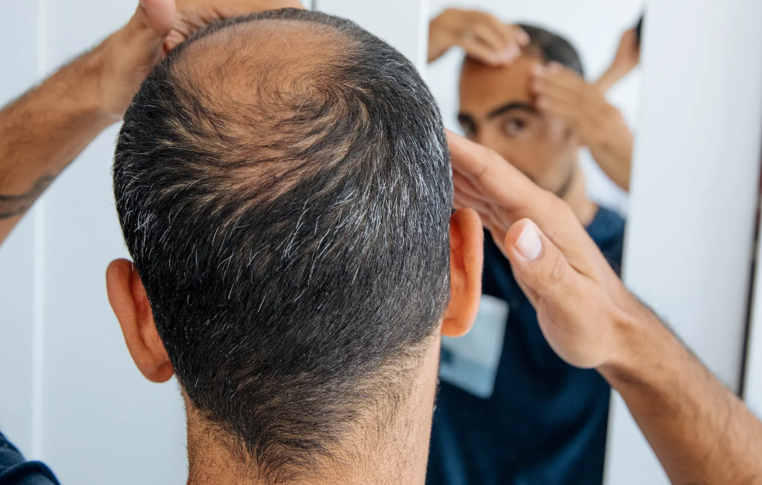 ¿Qué contienen las bebidas energéticas que daña tanto tu cabello?