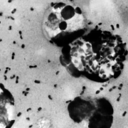 ¿Cuál fue la primera pandemia? Expertos creen haber hallado la respuesta