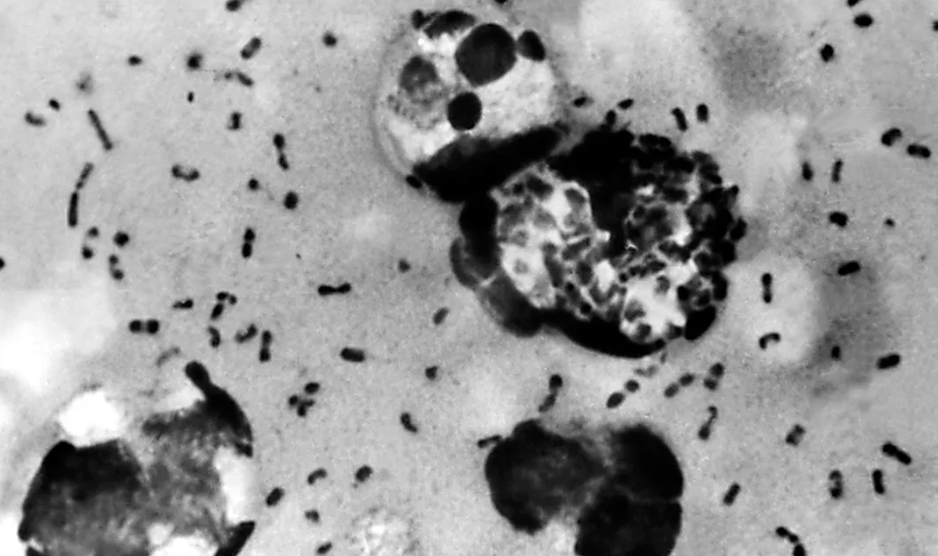 ¿Cuál fue la primera pandemia? Expertos creen haber hallado la respuesta