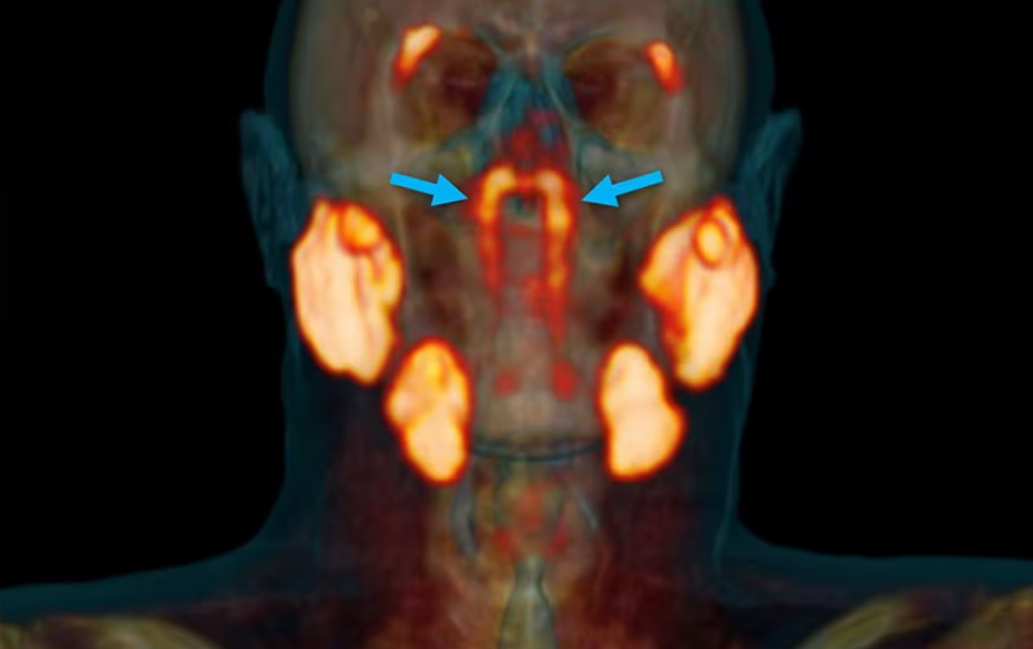 Tecnología que permitió el hallazgo