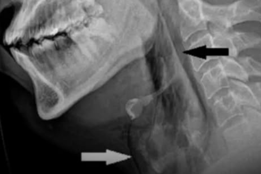 El caso clínico que desconcertó a los médicos