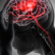Científicos revierten el daño cerebral causado por un accidente cardio vascular