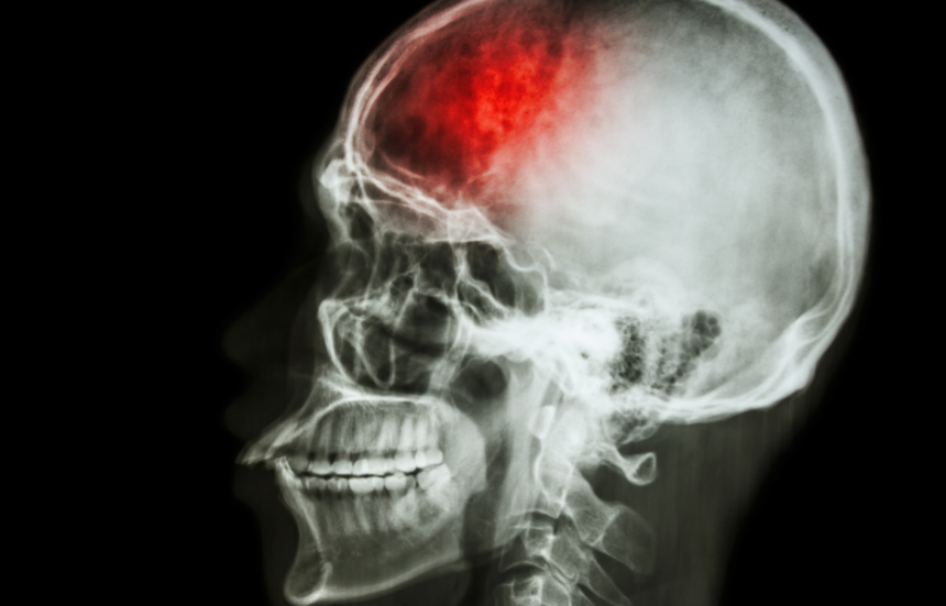Estudio muestra cómo los edulcorantes aumenten riesgo de infarto