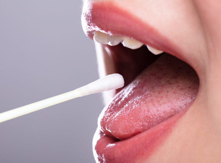¿La Saliva realmente cura? Un estudio cree demostrar que si