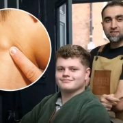 Un peluquero salva una vida al notar un extraño bulto en el cuello de uno de sus clientes