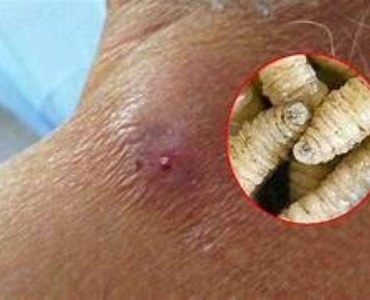 Preocupación en Yucatán: confirman otro caso de miasis por gusano barrenador