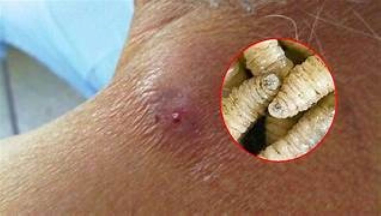 Preocupación en Yucatán: confirman otro caso de miasis por gusano barrenador