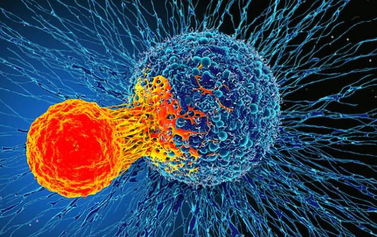 El desafío del cáncer de páncreas y cómo enfrentarlo