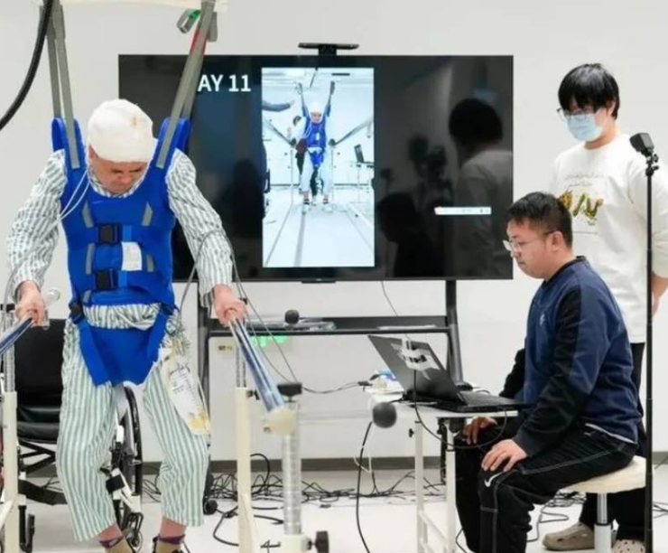 China devuelve la movilidad a personas paralizadas con un nuevo chip cerebral