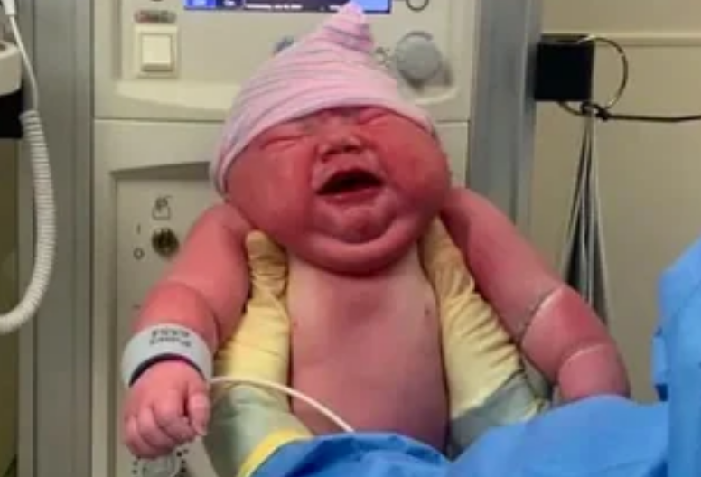 ¿Qué tan inusual es este peso para un recién nacido?